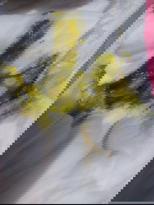 PUP WARNA HIJAU PADA BAYI