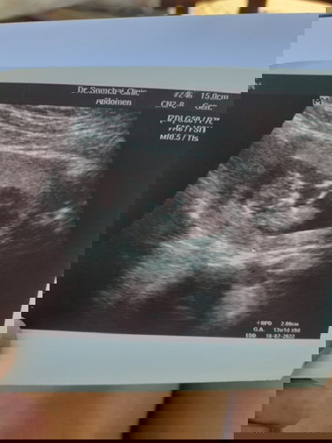 ขอดูภาพซาวด์แม่ๆหน่อยจ้า