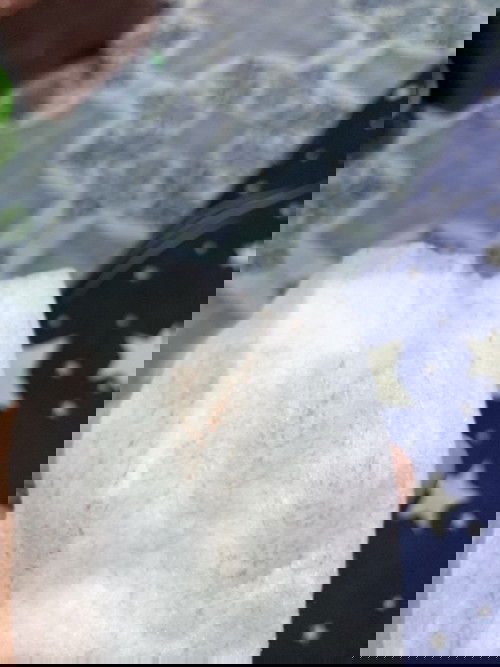 ตั้งครรภ์36 w1dเลือดออก