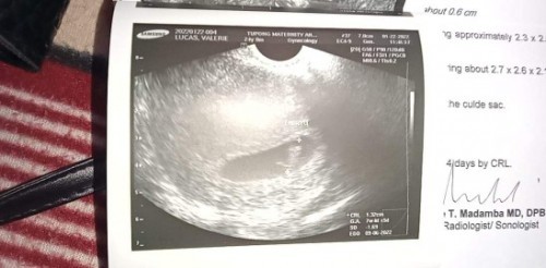 Napakasaya ko.βΊοΈ