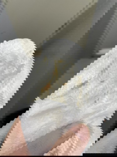 มีแม่ๆบ้านไหนตอนท้องอ่อนๆเป็นแบบนี้บ้างไหมคะ