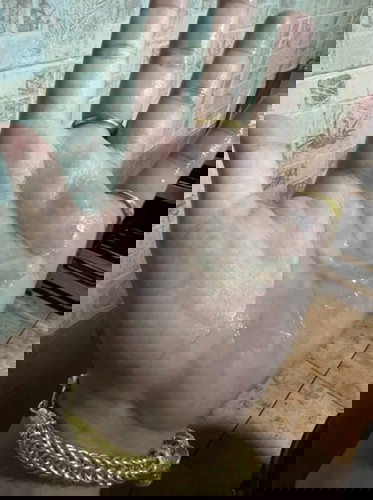 มีมูกแบบนี้คาดว่าอีกกี่วันคลอดคะตอนนี้ 38 5