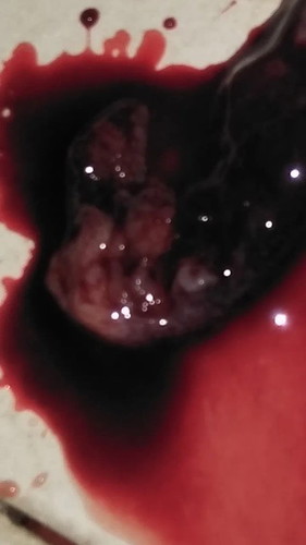 สงสารใจแทบขาด.หนูไปอยู่ตรงไหนมาลูกทำไมหมอถึงซาวไม่เคยเจอหนูบีบใจแม่ที่สุด