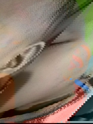 TEETHING STAGE SI LO