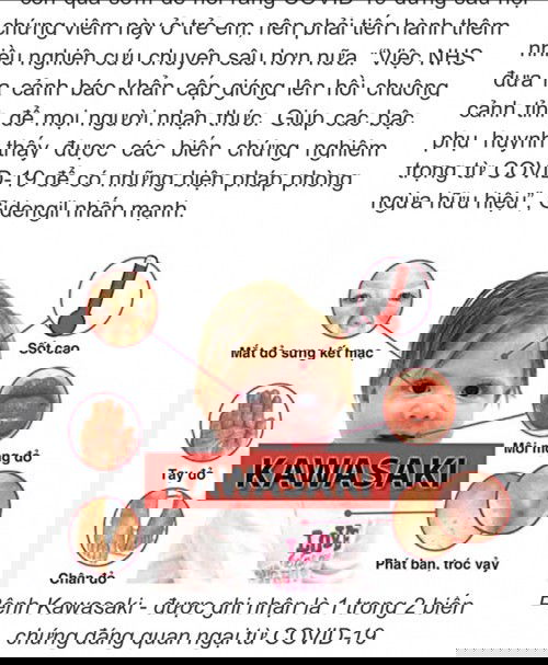 Cm có biết về hội chứng Kawasaki không?