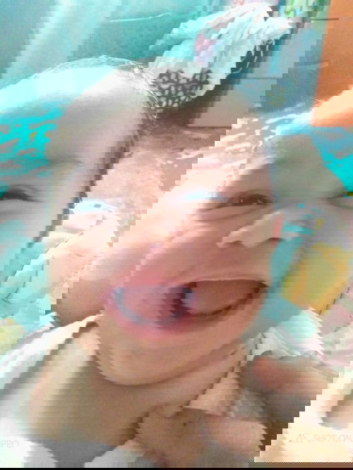 Normal lNg po ba to?