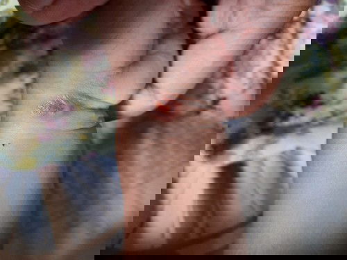 Awalnya bintik2 terus jadi seperti bisul, kemudian menghilang.