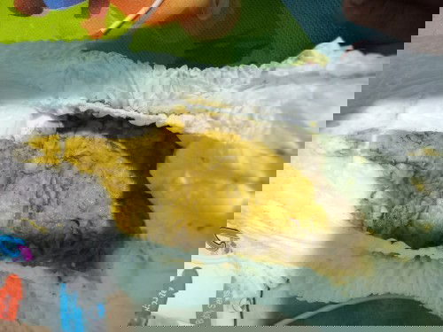 ลูกถ่ายแบบนี้ปกติไหมคะ