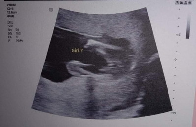 ช่วยดูเพศน้องให้หน่อยค่ะแม่ๆ ท้องแรกตื่นเต้นมากๆ 🥰