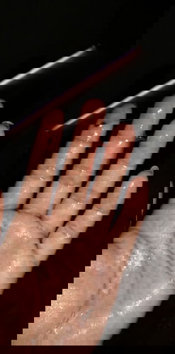 โดนกระตุ้นเมื่อเช้า กลับบ้านก้มีมูกเลือดออก แบบนี้ต้องไปหาหมอมั้ยค่ะ