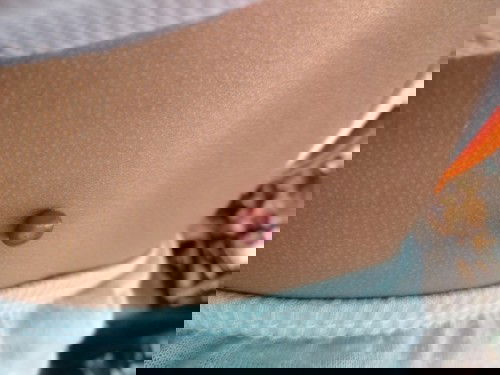 Benjolan di punggung anakku,,