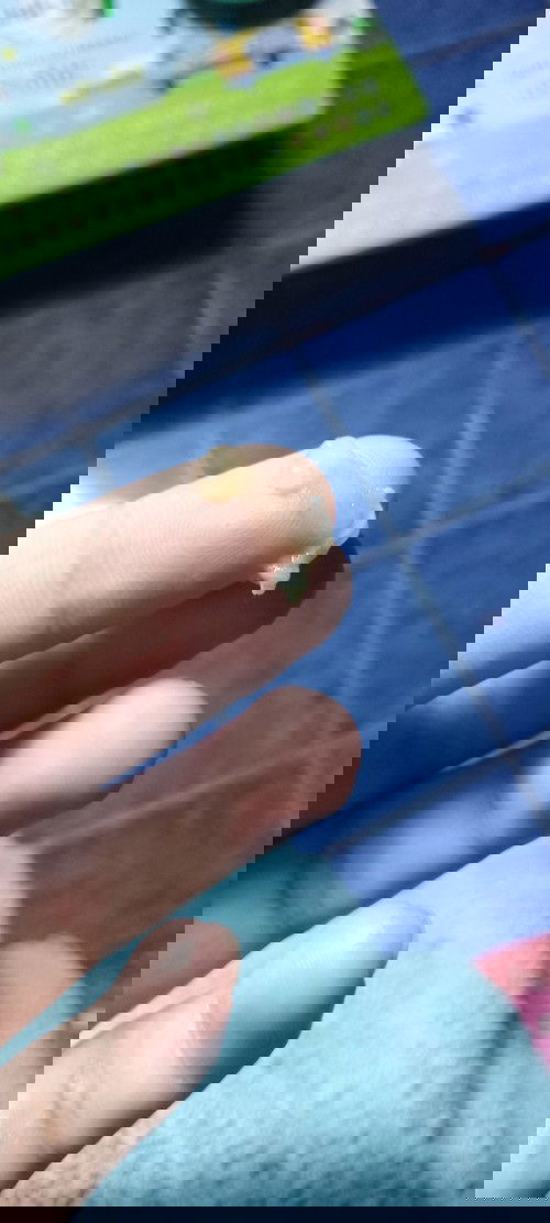 ท้องได้37+3วีค