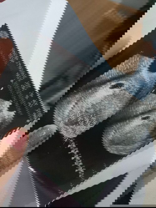 Hpht dengan hasil USG beda