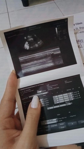 Helooo goodevening sino po kaya maalam tumingin ng ultrasound kung boy or girl? Thankyouuuu 🙂