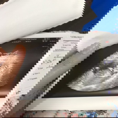 ทีมกรกฎา65
อิแม่ปวดหลังไม่ไหวแล้วเด้ออออออ