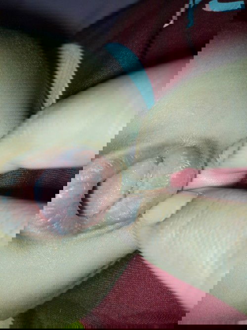 Ruam putih pada mulut bayi