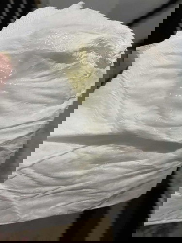 Normal lang ba na ganito ang discharge pag buntis? I’m currently 35 weeks.