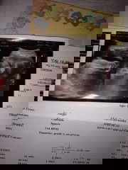 Pa help naman po ng magandang name sa baby girl ty sa sasagot😊