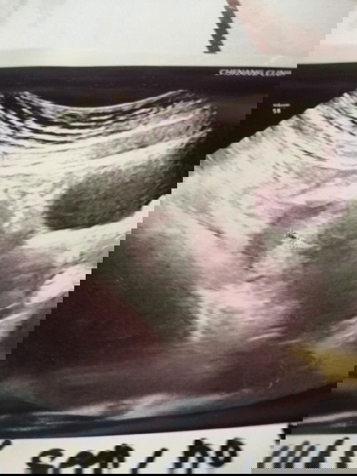 Sy scan 4weeks
Klau ikut skrg dh 6week
Tp td kluar darah period.tp tk bnyk sikit2 ja. Ada y mcm sy x