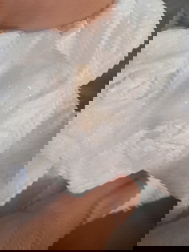 มูกแบบนี้คืออะไรคะ