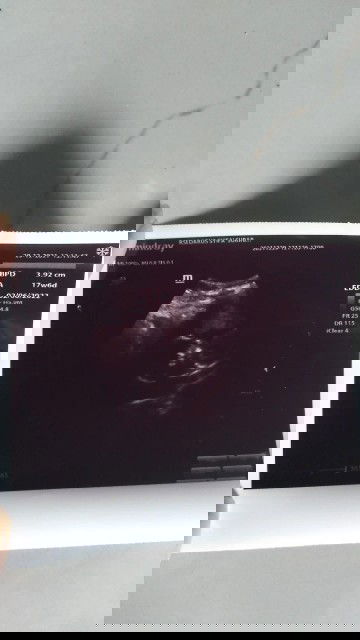 Usia sesuai dengan usia kehamilan atau tidak?