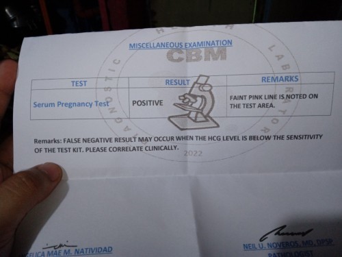 Positive serum test but negative urine test. Please help me.