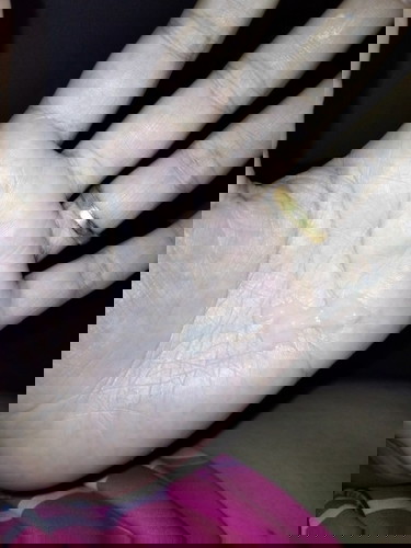 เป็นมูกหรือตกขาว