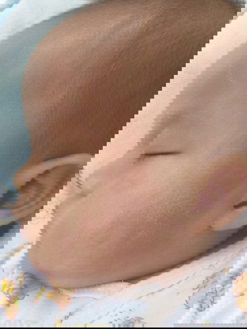 แบบนี้เกิดจากอะไรค่ะ