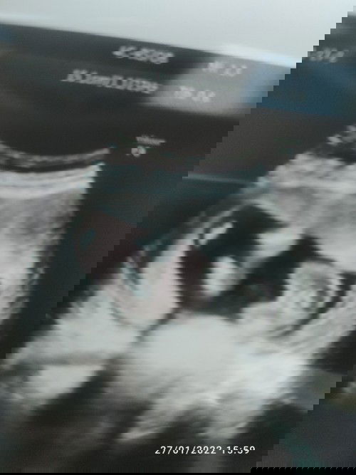 ขอดูอันตราซาวที่หมอบอกว่าลูกสาวหน่อยค่ะ