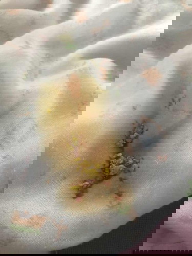 น้องถ่ายเเบบนี้ผิดปกติไหมค่ะ