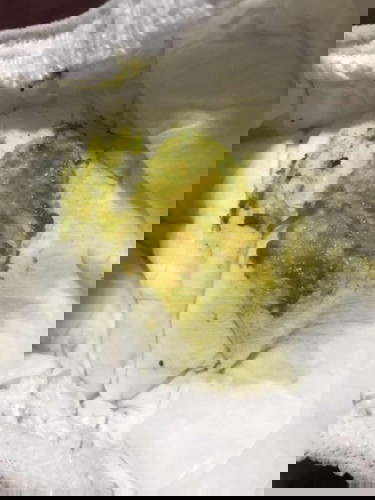 อึสีนี้จะเป็นอะไรไหมค่ะ ไครเป็นบ้าง