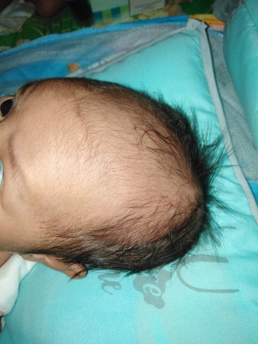 ask ko lang, pano maging round ang hugis ng ulo ni baby? 1mon.4days n po sya, TIA
