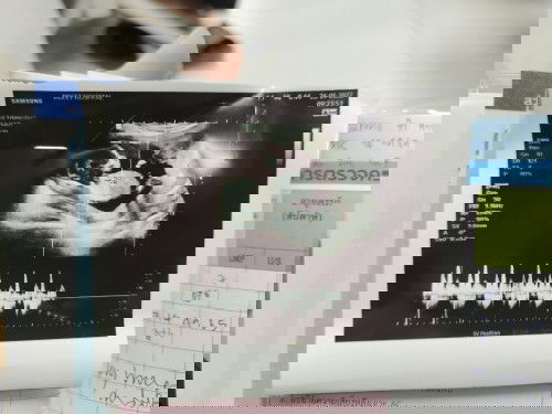 แม่ๆคิดว่าจะได้ ช หรือ ญ ค่ะ!!!