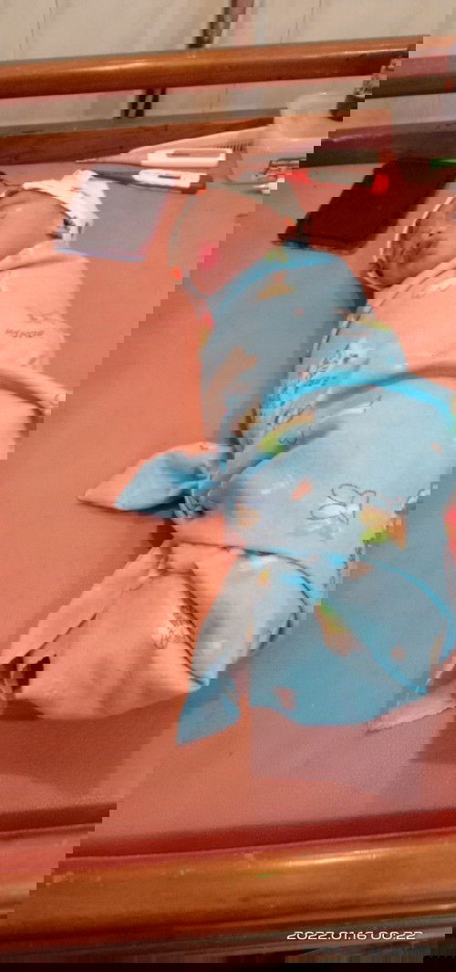 Lahir Prematur 34w+4d