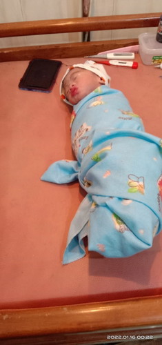 Lahir Prematur 34w+4d