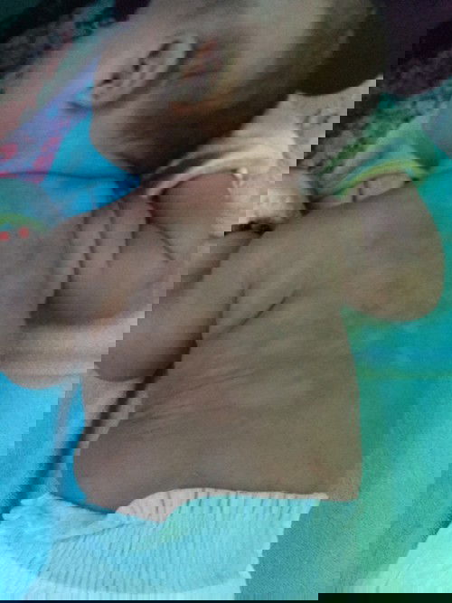 Puting parang pantal at magaspang