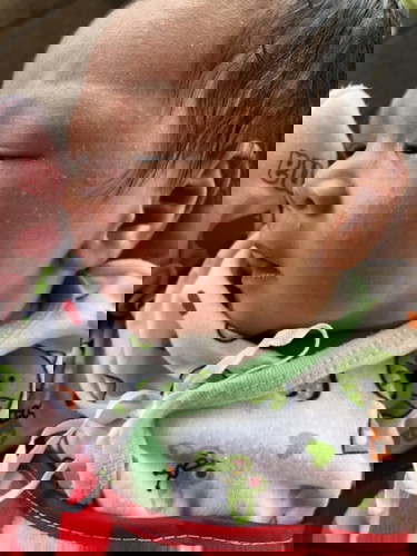 มีผื่นขึ้นหน้าทำอย่างไรดีค่ะ