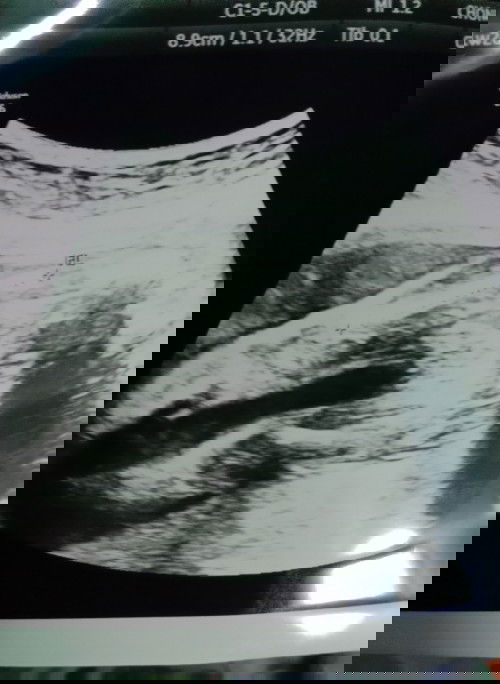 ขอสอบถามหน่อยค่ะแม่แม่