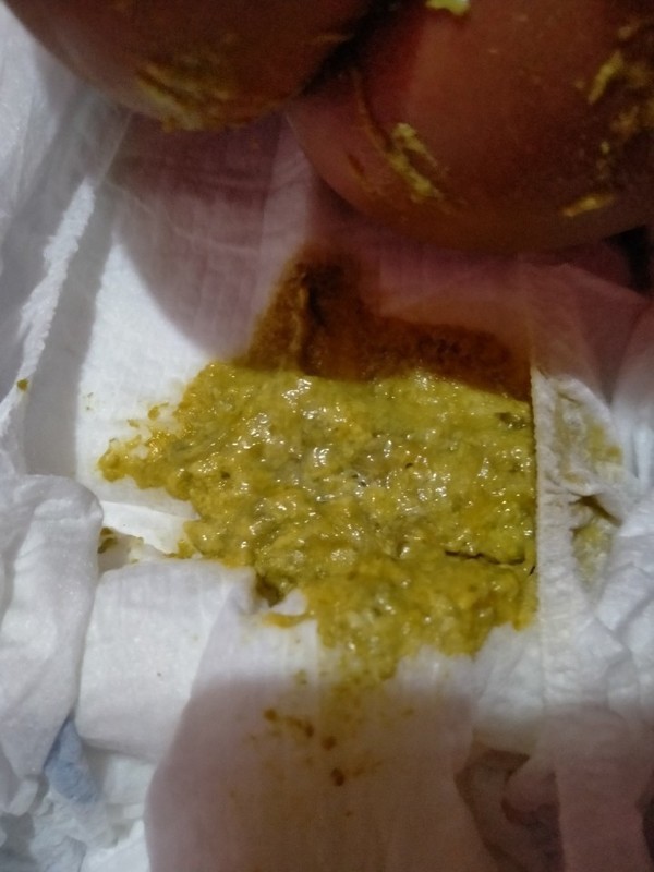 Baby poop,formula fed bonna