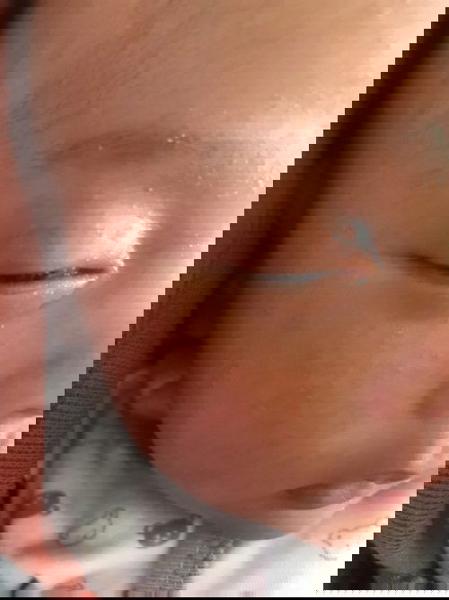 Cara menghilangkan bintik merah