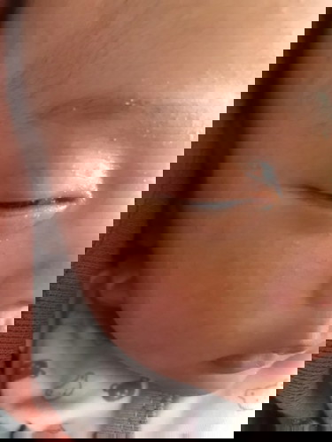 Cara menghilangkan bintik merah