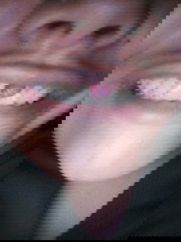 ขอคำแนะนำเกี่ยวกับเหงือ