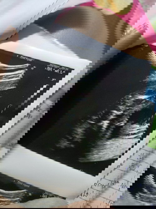 มีจู๋รึมีจิ๋มคะ