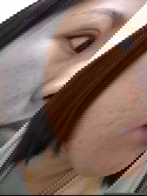 เป็นเพราะท้องหรือแพ้อะไร