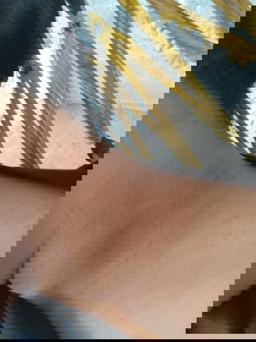 คอดำเหมือนขี้ไคลแต่ขัดไม่ออก คุณแม่บ้านไหนเป็นบ้างคะ