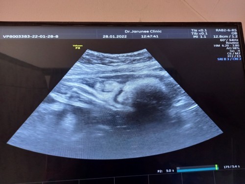 อวดน้ำหนักbaby