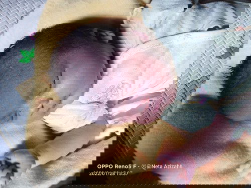 kulit kepala timbul biyang keringat lalu timbul bentol berair sperti melepuh