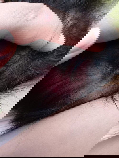 Kepala bayi saya memerah