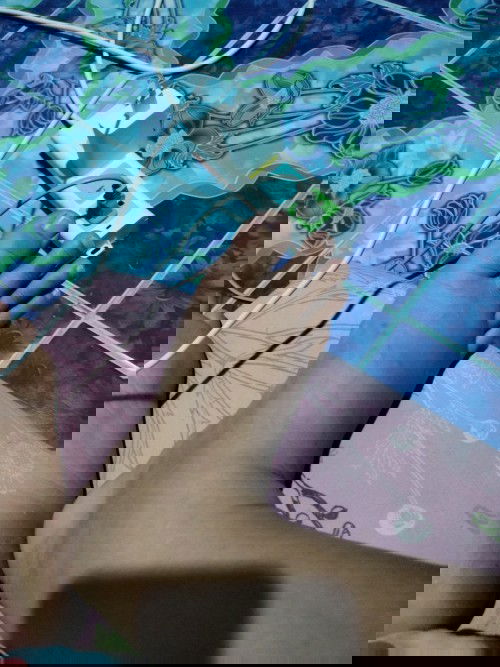 มีใครเท้าบวมแบบนี้ไหม