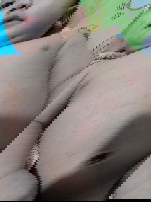 เป็นมา2วันแล้วค่ะ